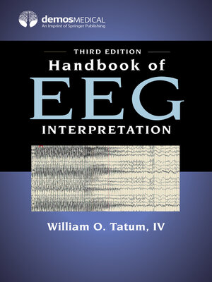 cover image of Handbook of EEG Interpretation